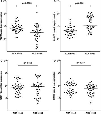 TCF21/POD-1, a Transcritional Regulator of SF-1/NR5A1, as a Potential Prognosis Marker in Adult and Pediatric Adrenocortical Tumors